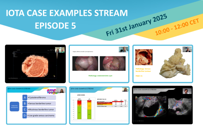 Case Examples Stream EP 5