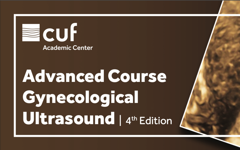 CUF
